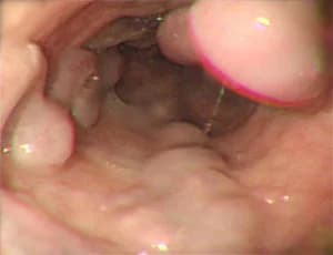 Surgical Gastroenterology